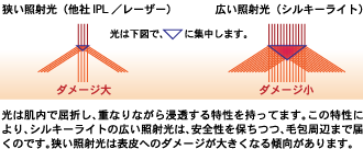 照射光の比較イメージ図